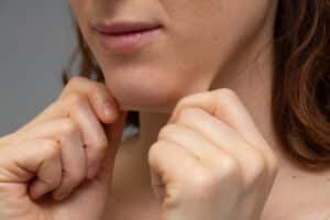 Woman pulls on her loose skin under her chin before a Morpheus8 treatment