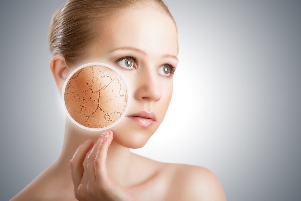 Woman in Salt Lake City touches her cheek, with a circle showing a close-up of dry, cracked skin superimposed over her right cheek