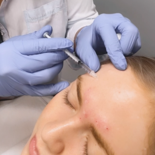 botox 5