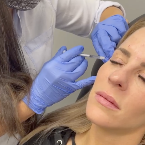 botox photo 7